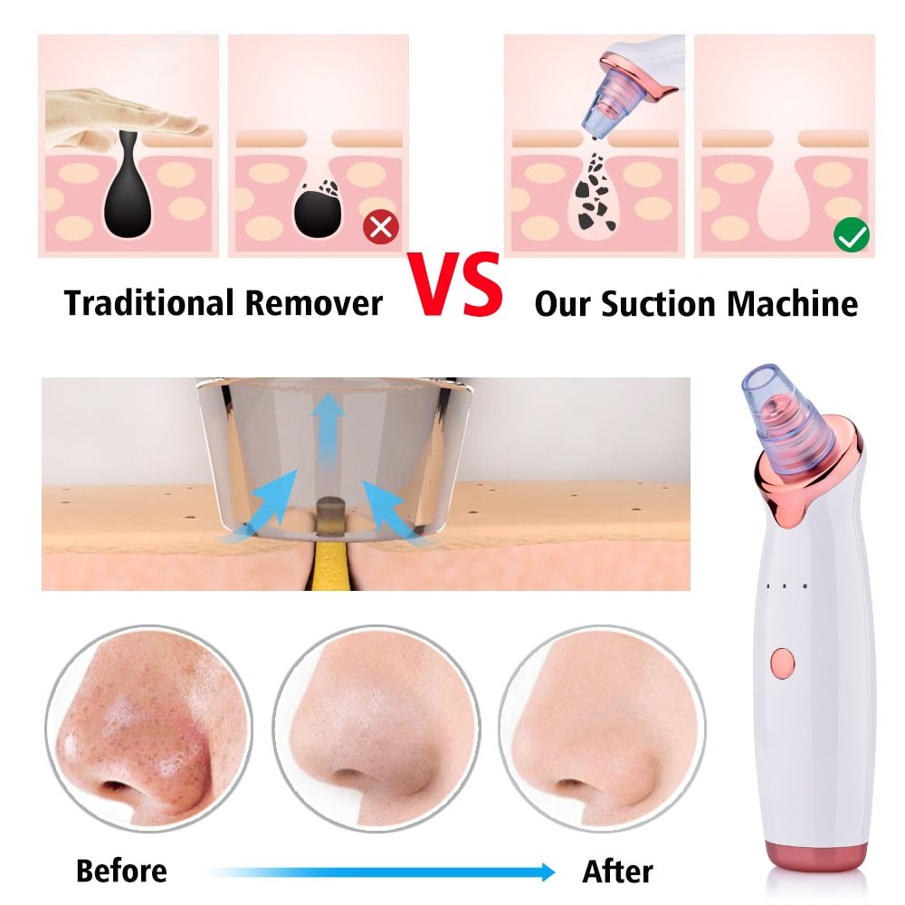 Blackhead Instrument Electric Suction Facial Washing Instrument Beauty Acne Cleaning Blackhead Suction Instrument CJdropshipping