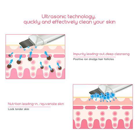 Ultrasonic Skin Scrubber Face Cleanser Blackhead Acne Removal Facial Spa Vibration Massager Ultrasound Peeling Clean Machine 394 CJdropshipping