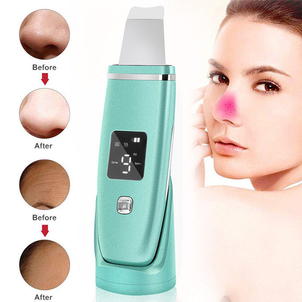 Ultrasonic Vibration Blackhead Remover Deep Cleansing Face Scrubber Pore Cleaner Lifting Machine Facial Led Peeling Shovel CJdropshipping